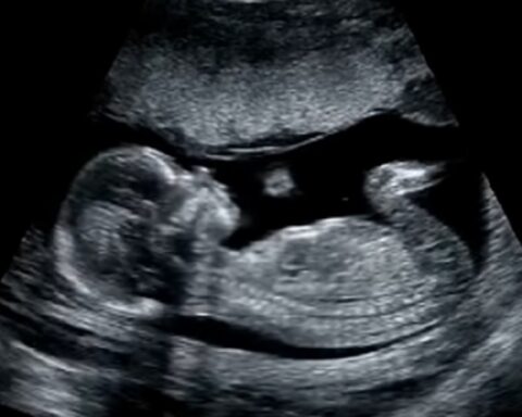 SZO: Abortusi su izbrisali skoro trećinu generacije širom sveta