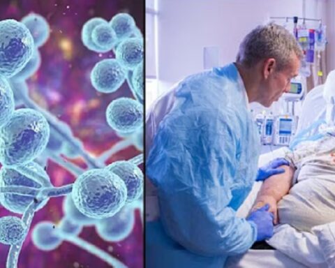 Гљивица Ц. аурис се експресно шири по европским болницама