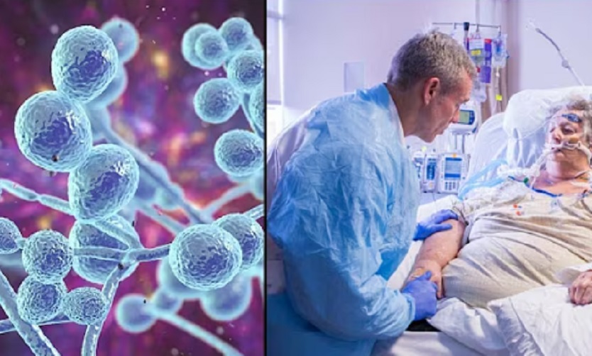 Гљивица Ц. аурис се експресно шири по европским болницама