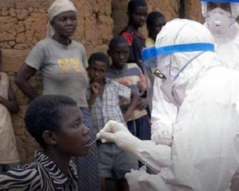 Етиопија пријавила шест жртава: Шири се Марбург вирус