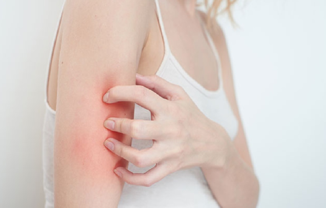 Psorijaza pogađa 43 miliona ljudi širom sveta: Holistički pristup preokreće bolest bez lekova – Farmako mafija skriva prirodne lekove!