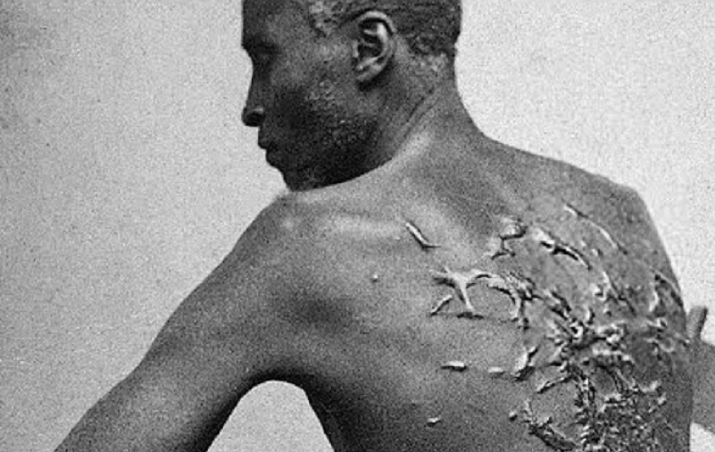 Šef UN za ljudska prava traži odštetu za ropstvo: Svet podeljen oko „reparacione pravde“