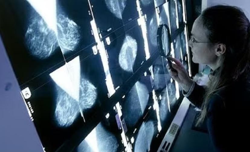 SZO upozorava: Broj obolelih od raka mogao bi da se udvostruči do 2050. godine